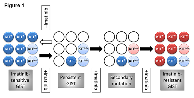 Figure 1. Hypothetical stem cell model of GIST persistence and acquired therapy resistance. Light blue circles: KIT-independent precursors carrying imatinib-sensitive KIT mutation but expressing very little or no KIT protein (KITlow/–). Dark blue circles: KIT+ cells arising from the KITlow/– cells carrying imatinib-sensitive KIT mutation. Open circles: dead cells. Pink circles: KITlow/–, KIT-independent precursors with acquired secondary imatinib-resistant mutation. Red circles: KIT+ cells differentiated from the KITlow/– precursors with secondary imatinib-resistant mutation. Filled arrow: imatinib treatment. Open arrow: cessation of imatinib treatment.